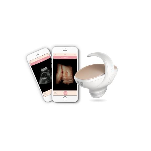 CE Approved 3D/4D Handheld Fetal Ultrasound Scanner
Portable Pregnancy Imaging Solution with 60° Wide-Angle Convex Probe
