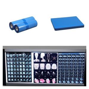 Cheap Medical Inkjet X Ray Films For CT MRI DR CR Image Output Compatible With HP Printer for sale