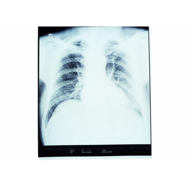 High Sharpness Medical Diagnostic Imaging , Dry AGFA X Ray Film