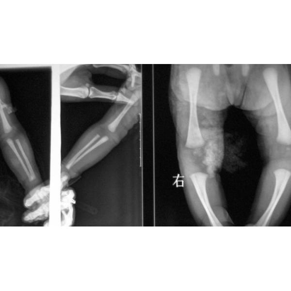 Medical Dry Digital X Ray Film For Thermal Printer 11in x 14in