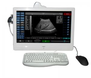 Cheap electronic colposcope software/touch screen ultrasound machine for sale