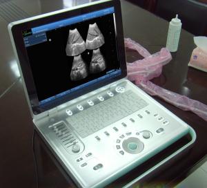 Cheap Digital hand held ultrasound for sale