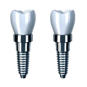 Cheap Consistency In Every Crown Our Dental Implant Crown Manufacturing Process for sale