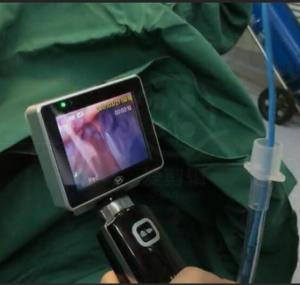 China ICU EMS Single Use Intubation Video Laryngoscope With 1280 X 720 Camera Resolution on sale