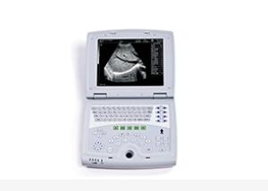 Mobile Ultrasound Machine Digital Laptop Ultrasound Scanner with 100 Frames Permanent Storage