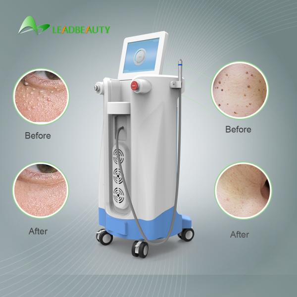 For Blood Spider clearance 980nm Diode Laser Spider Vein Removal Machine