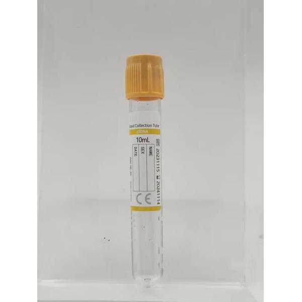 Anticoagulant SST PRP ACD Gel Tube Blood Collection