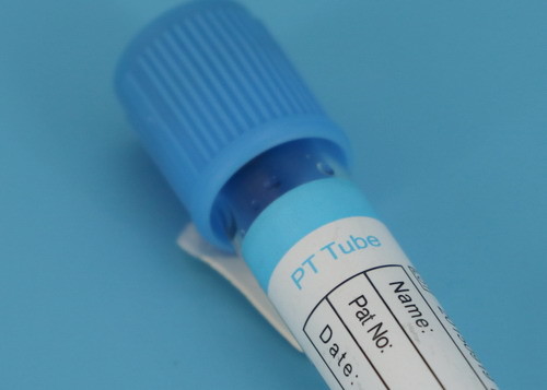 Medical Disposable Centrifuge Tube / Blood Collection Tube CE ISO Approved