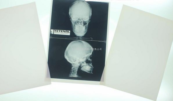 Konida 10in X 12in X Ray Medical Imaging