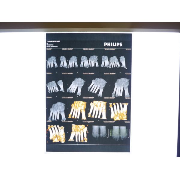 Diagnostic AGFA Digital X Ray Film Waterproof With Bright Tone