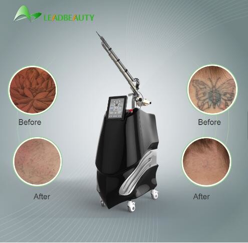 10% Discount: the Christmas promotion Tattoo removal birthmark removal 1064/532/755nm
