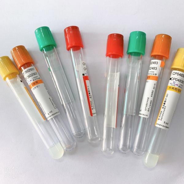 CE Certificated Blood Collecting Tube For Medical Sodium Fluoride Potassium Oxalate