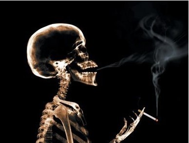 Low Fog 10 x 12inch X Ray Medical Imaging For AGFA 5300 / 5302 / 5500