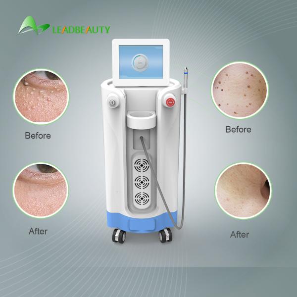 For Blood Spider clearance Diode Laser Spider Vein Removal Machine 980nm