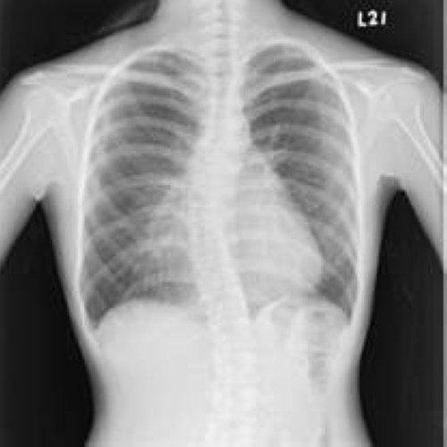 Wearable White Base Medical X Ray Films , Medical Imaging X-ray Paper Film