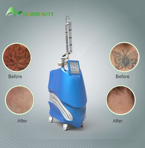 PICOSURE Nd:YAG laser  for tattoo removal, Ota removal; Acne removal; Tattoo removal