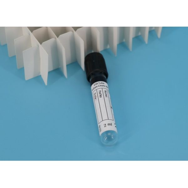 No Additive Tube Laboratory Vacuum Serum Blood Collection Tube