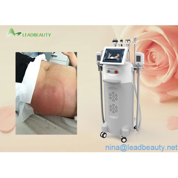5 Big heads Cryo/Ultrasound/RF heads multi-functional cryolipolysis slimming machine